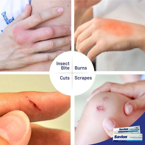 Savlon Antiseptic Cream 100g