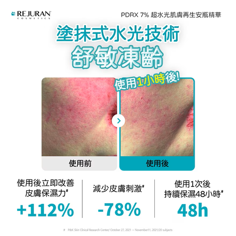 Rejuran Moisture Treatment Ampoule 30ml