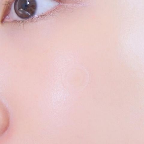 Care Plus 隱形暗瘡貼痘痘貼 102貼 (包裝隨機發貨)
