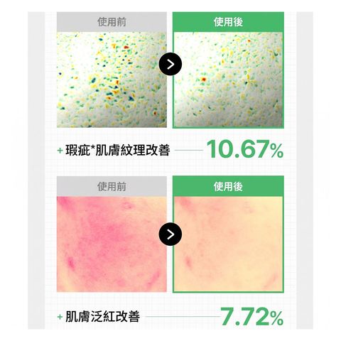 Mediheal Teatree Trouble Pad (100 Pieces + Refill 100 Pieces with Portable Case & Sticker) 1 Set [Parallel Import]